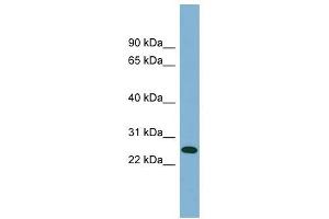 ITGB1BP3 antibody used at 1 ug/ml to detect target protein. (ITGB1BP3 抗体  (Middle Region))