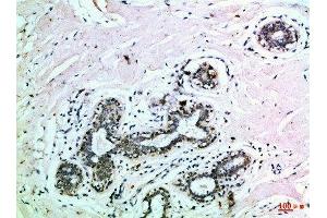 Immunohistochemical analysis of paraffin-embedded Human-breast, antibody was diluted at 1:100 (EPH Receptor B3 抗体  (AA 650-700))