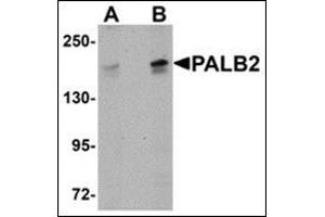 Western blot analysis of PALB2 in SK-N-SH cell lysate with this product at (A) 1 and (B) 2 μg/ml. (PALB2 抗体  (C-Term))