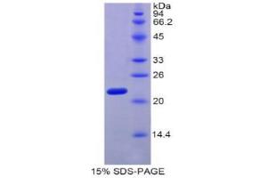 SDS-PAGE (SDS) image for Myosin Light Chain 4, Alkali, Atrial, Embryonic (MYL4) (AA 4-187) protein (His tag) (ABIN1877992)