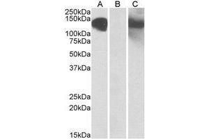 HEK293 lysate (10µg protein in RIPA buffer) overexpressing Human CDH11 with C-terminal MYC tag probed with AP21503PU-N (1µg/ml) in Lane A and probed with anti-MYC Tag (1/1000) in lane C. (OB Cadherin 抗体  (Internal Region))