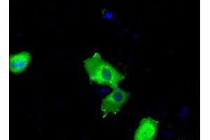 Image no. 7 for anti-Bruton Agammaglobulinemia tyrosine Kinase (BTK) antibody (ABIN1496976) (BTK 抗体)