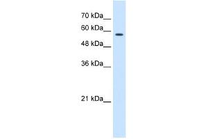 WB Suggested Anti-CCT8 Antibody Titration:  0. (CCT8 抗体  (C-Term))