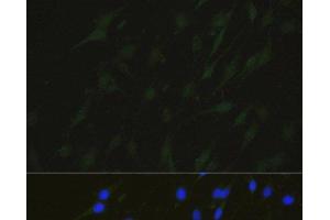 Immunofluorescence analysis of C6 cells using NHEJ1 Polyclonal Antibody at dilution of 1:100.