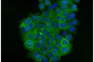 IF analysis of Cytokeratin 5 using anti-Cytokeratin 5 antibody (ABIN7602992). (Cytokeratin 5 抗体  (Middle Region))