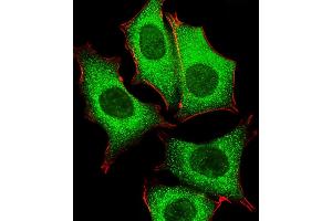 Fluorescent image of MCF-7 cells stained with GLD2 Antibody (N-term) (ABIN651284 and ABIN2840170). (PAPD4 抗体  (N-Term))