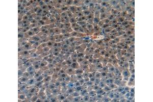IHC-P analysis of liver tissue, with DAB staining. (CASP14 抗体  (AA 1-257))