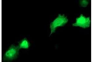 Anti-RBP1 mouse monoclonal antibody (ABIN2454526) immunofluorescent staining of COS7 cells transiently transfected by pCMV6-ENTRY RBP1 (RC214515). (RBP1 抗体)