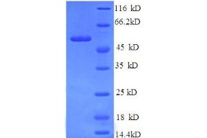 Vinculin (VCL) (AA 2-235), (partial) protein (GST tag)