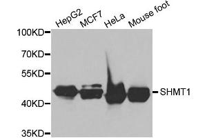 Western blot analysis of extracts of various cell lines, using SHMT1 antibody. (SHMT1 抗体)