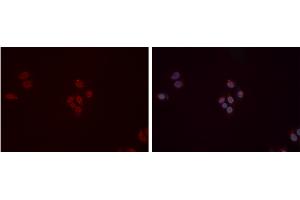 ABIN6277358 staining Hela cells by IF/ICC. (DDB1 抗体  (C-Term))