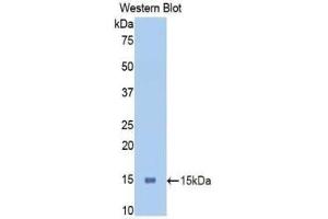 Western blot analysis of the recombinant protein. (PIGR 抗体  (AA 463-563))