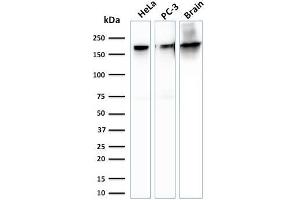 Western Blotting (WB) image for anti-Spectrin, Beta, Non-erythrocytic 2 (SPTBN2) (AA 356-475) antibody (ABIN6940654)