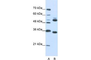 WB Suggested Anti-WDR6 Antibody Titration:  0. (WDR6 抗体  (C-Term))
