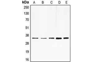 Western blot analysis of E2F6 expression in HeLa (A), HepG2 (B), K562 (C), mouse muscle (D), rat heart (E) whole cell lysates. (E2F6 抗体  (Center))