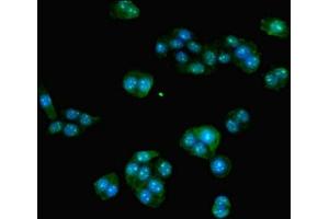 Immunofluorescent analysis of PC-3 cells using ABIN7155729 at dilution of 1:100 and Alexa Fluor 488-congugated AffiniPure Goat Anti-Rabbit IgG(H+L) (HOXA9 抗体  (AA 1-190))