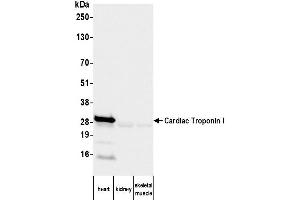 Western Blotting (WB) image for anti-Cardiac Troponin I (TNNI3) antibody (ABIN7795611)
