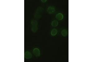 Anti-HHex mouse monoclonal antibody (ABIN2452343) immunofluorescent staining of HeLa cells transiently transfected by pCMV6-ENTRY HHex (RC204815) (HHEX 抗体  (AA 100-270))