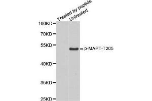 Western Blotting (WB) image for anti-Microtubule-Associated Protein tau (MAPT) (pThr205) antibody (ABIN3019698) (MAPT 抗体  (pThr205))