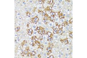 Immunohistochemistry of paraffin-embedded rat liver using WNT1 antibody (ABIN1683291, ABIN3016105, ABIN3016107 and ABIN6219551) at dilution of 1:100 (40x lens).