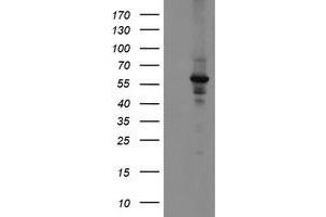 Western Blotting (WB) image for anti-Diphthamide Biosynthesis Protein 2 (DPH2) antibody (ABIN1497894) (DPH2 抗体)