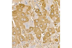 Immunohistochemistry of paraffin-embedded human liver using [KO Validated] RA Rabbit pAb (ABIN3021646, ABIN3021647, ABIN3021648 and ABIN1513457) at dilution of 1:100 (40x lens). (RAB5 抗体  (AA 1-215))