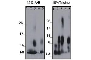 Western blots of the monoclonal antibody binding to different amyloid beta (Abeta) regions of human and mouse protein, using 12% A/B (acrylamide/bisacrylamide) or 10% Tricine matrix. (beta Amyloid 抗体  (C-Term))