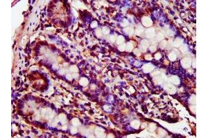 Immunohistochemistry (IHC) image for anti-Lectin, Galactoside-Binding, Soluble, 9 (LGALS9) (AA 1-323) antibody (ABIN7153467)