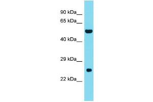 Host: Rabbit Target Name: DNAAF3 Sample Type: Fetal Liver lysates Antibody Dilution: 1. (DNAAF3 抗体  (C-Term))