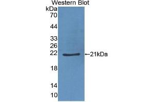 Western Blotting (WB) image for anti-Hemoglobin beta (HBB) (AA 1-147) antibody (ABIN1868325)