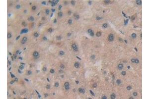 Detection of RSPO1 in Human Liver Tissue using Polyclonal Antibody to R-Spondin 1 (RSPO1) (RSPO1 抗体  (AA 21-135))