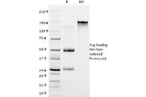 SDS-PAGE Analysis Purified Cytokeratin 16 Mouse Monoclonal Antibody (LL025).