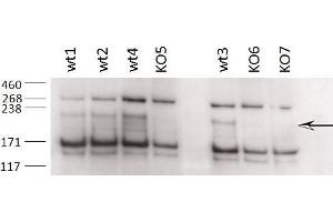 ABIN870646 (0. (ZCCHC11 抗体  (Internal Region))