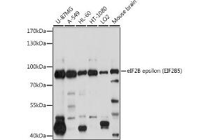 Western blot analysis of extracts of various cell lines, using eIF2B epsilon (eIF2B epsilon (EIF2B5)) antibody (ABIN6130359, ABIN6140041, ABIN6140042 and ABIN6214448) at 1:1000 dilution. (EIF2B5 抗体  (AA 442-721))