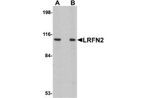 Western Blotting (WB) image for anti-Leucine Rich Repeat and Fibronectin Type III Domain Containing 2 (LRFN2) (C-Term) antibody (ABIN1030490) (LRFN2 抗体  (C-Term))