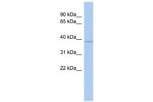 WBP2NL antibody used at 1 ug/ml to detect target protein. (WBP2NL 抗体  (Middle Region))