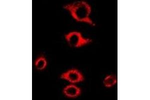 Immunofluorescent analysis of RPL9 staining in MCF7 cells.