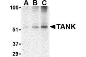 Western blot analysis of TANK in Daudi cell lysate with this product at (A) 0.