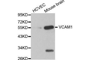 Western blot analysis of extracts of various cell lines, using VCAM1 antibody. (VCAM1 抗体  (AA 300-400))