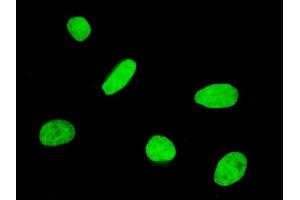 Immunofluorescence of monoclonal antibody to FOXQ1 on HeLa cell. (FOXQ1 抗体  (AA 110-219))