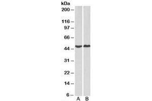 Western blot testing of human A) HeLa and B) MCF7 cell lysate with PRKACA antibody at 2ug/ml. (PRKACA 抗体)