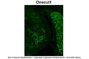 Immunohistochemistry (IHC) image for anti-One Cut Homeobox 1 (ONECUT1) (C-Term) antibody (ABIN2777516) (ONECUT1 抗体  (C-Term))