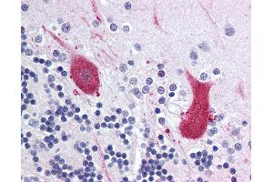 Anti-MARK1 antibody IHC of human brain, cerebellum. (MARK1 抗体  (Internal Region))