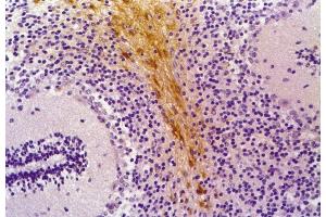 Immunohistochemistry staining of human cerebellum (paraffin-embedded sections) with anti-GFAP (clone GF-01). (GFAP 抗体)