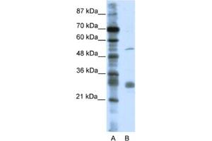 Western Blotting (WB) image for anti-Leucine Rich Repeat Containing 14 (LRRC14) antibody (ABIN2461029) (LRRC14 抗体)