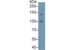 Detection of PLCb4 in Human A549 cell lysate using Polyclonal Antibody to Phospholipase C Beta 4 (PLCb4) (Phospholipase C beta 4 抗体  (AA 2-250))