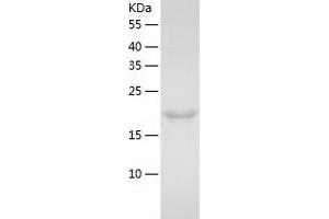 Western Blotting (WB) image for Signal Transducing Adaptor Molecule (SH3 Domain and ITAM Motif) 2 (STAM2) (AA 1-189) protein (His tag) (ABIN7125099)