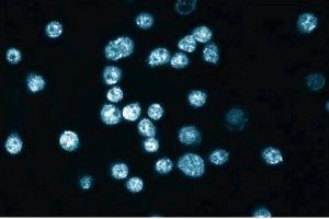 Immunofluorescence staining of HL-60 cells (Human promyelocytic leukemia, ATCC CCL-240). (Plakophilin 2 抗体  (AA 19-183))