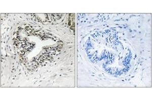 Immunohistochemistry analysis of paraffin-embedded human prostate carcinoma tissue, using RPL30 Antibody. (RPL30 抗体  (AA 66-115))