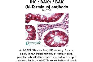 Image no. 1 for anti-BCL2-Antagonist/killer 1 (BAK1) (N-Term) antibody (ABIN1732215) (BAK1 抗体  (N-Term))